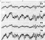 Control EEG chart of subject not introduced to EMR ofcellular phone 